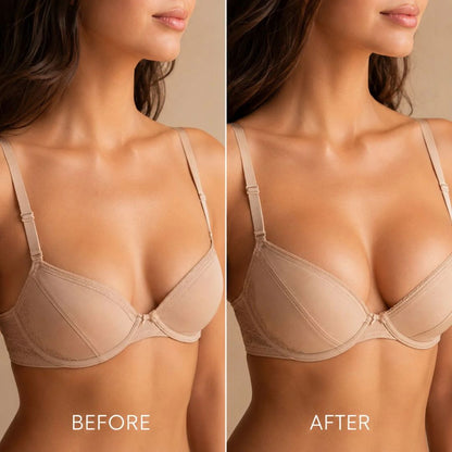 🔥LAST DAY SALE-80% OFF) ✨ Breast Enhance Mentmicroneedle Patch